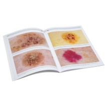 HEINE Dermatoskopie Kompendium