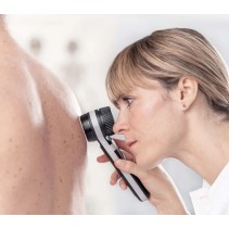 HEINE DELTA 30 Dermatoskop