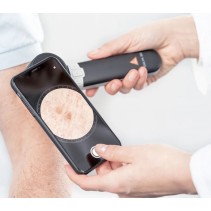 HEINE DELTA 30 Dermatoskop