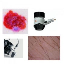 SLR Fotoadapter-Set für DELTA 20 Dermatoskop