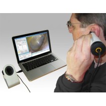 ORLvision USB Video Otoskop OX1